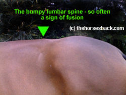 Lumbar 1